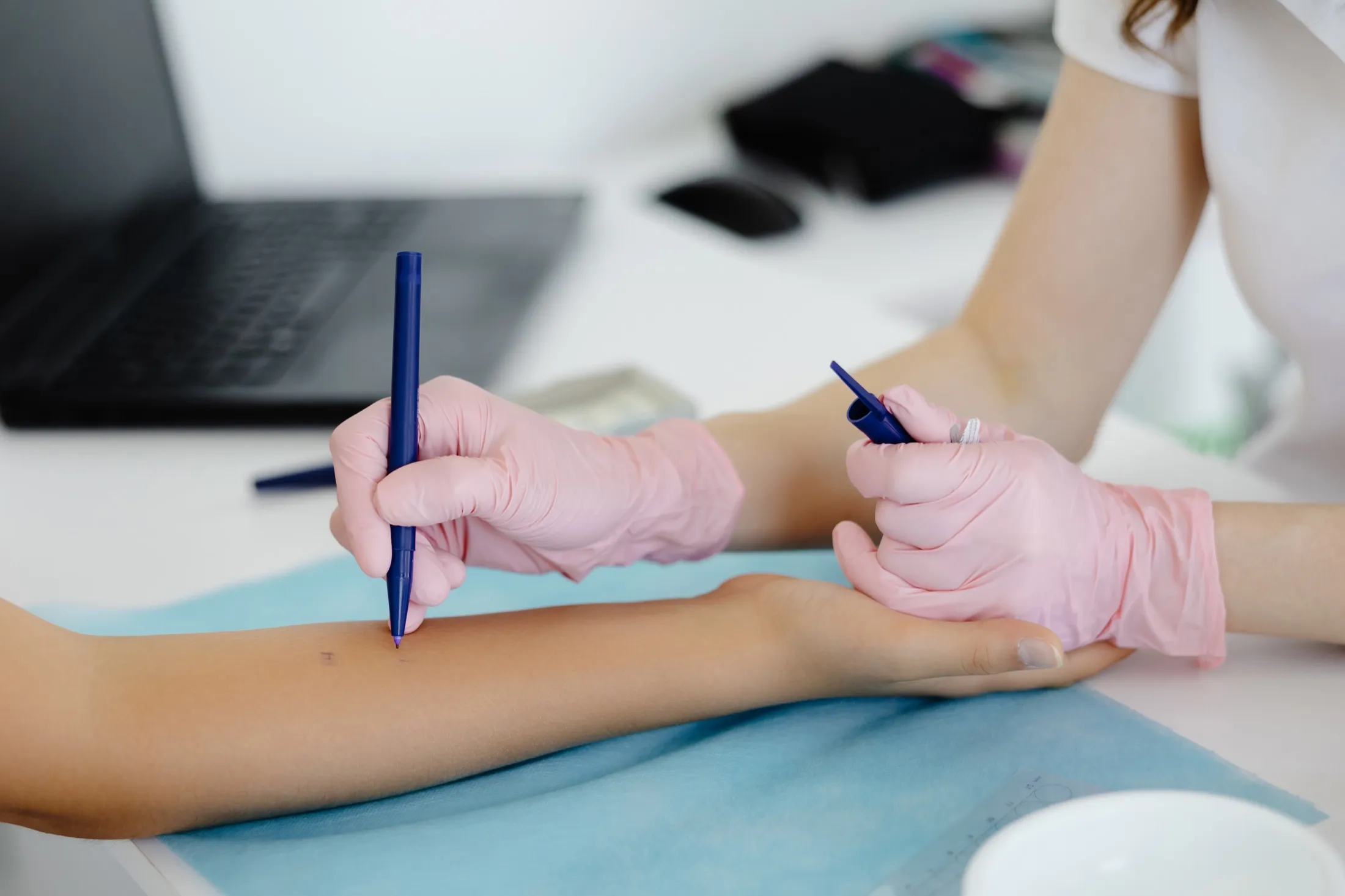 How Does Allergy Testing Work?
