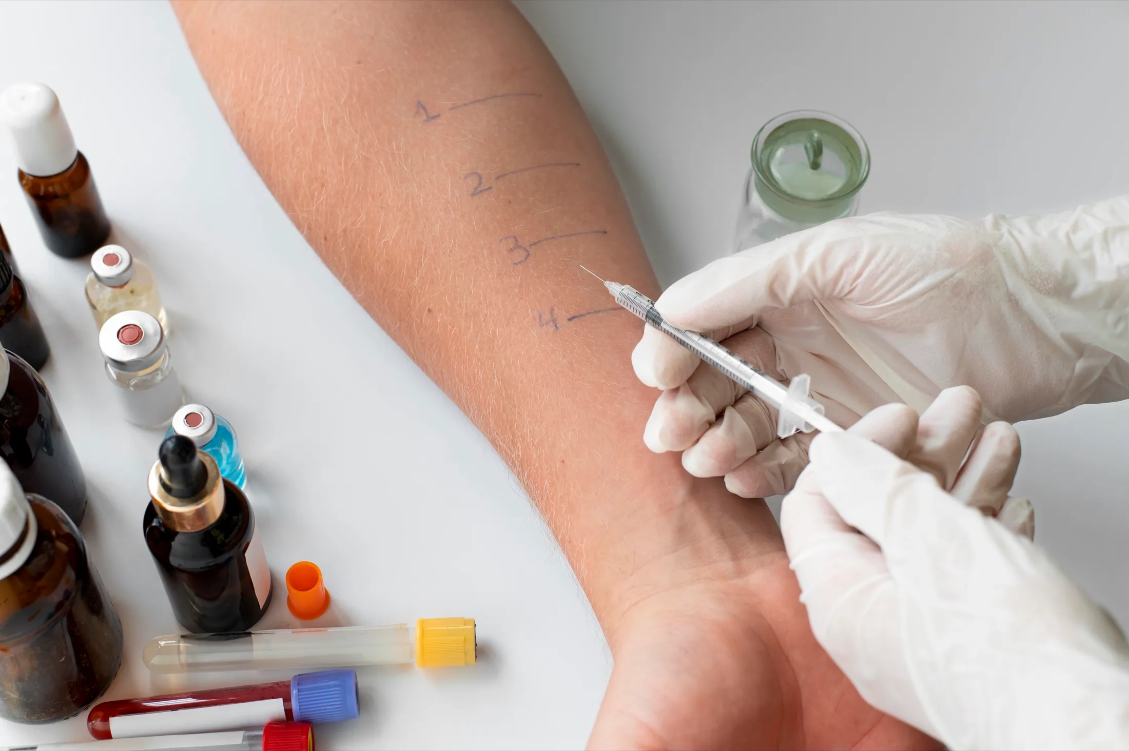 What to Expect: The Two Phases of Allergy Shots