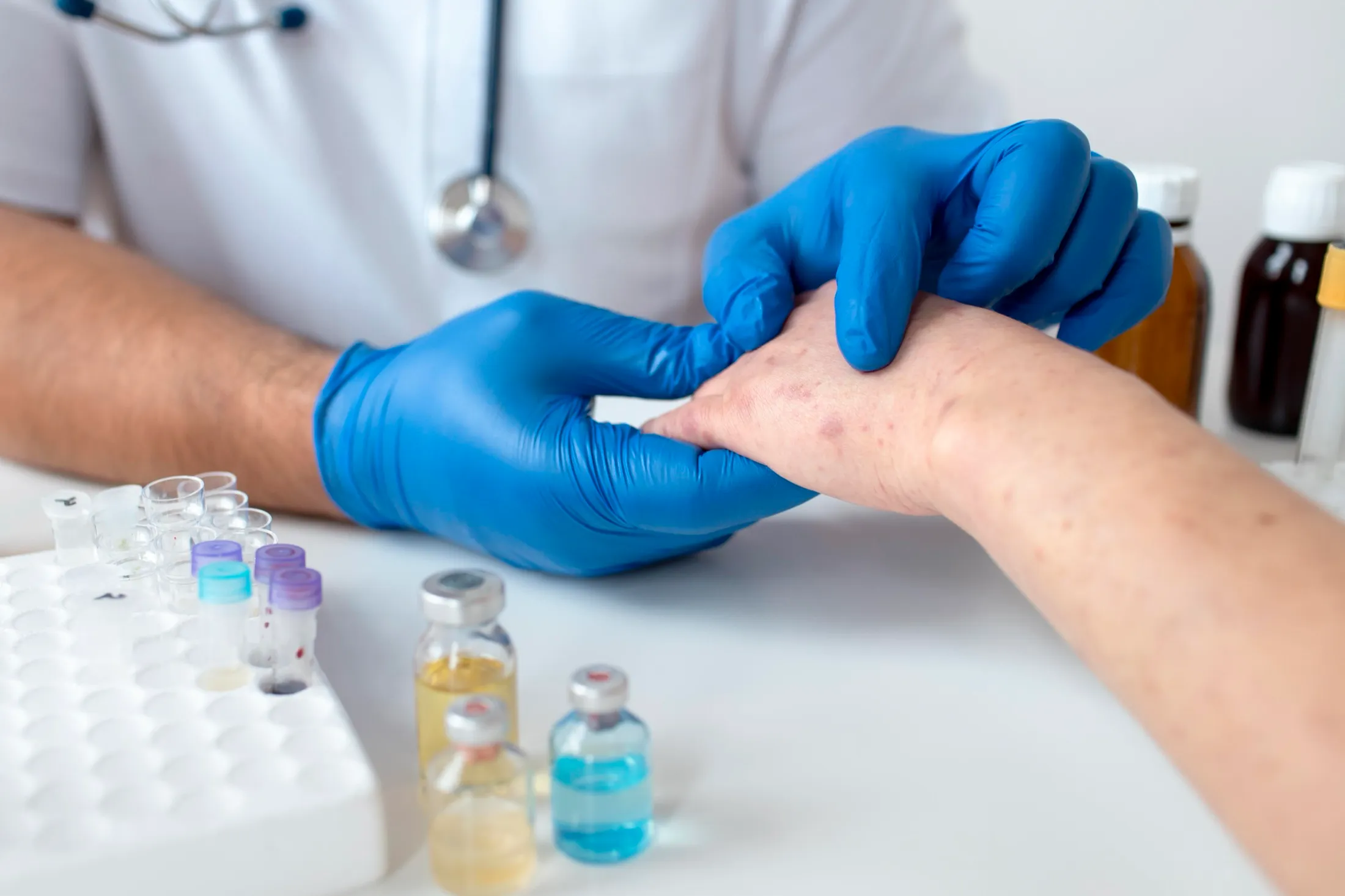 How We Diagnose Allergies